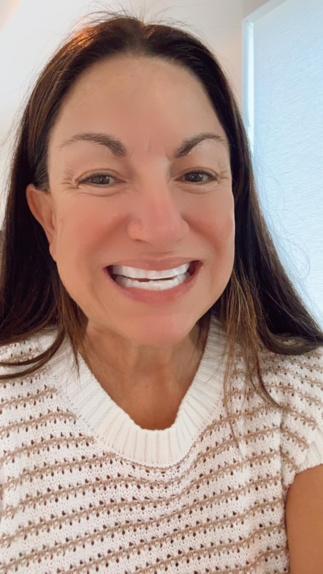 Opalescence Go 15% Mint - Prefilled Teeth Whitening Trays - Hydrogen Peroxide Formula (10 Treatments) - Dentist Developed - Low Sensitivity - Gentle on Enamel customer photo 2