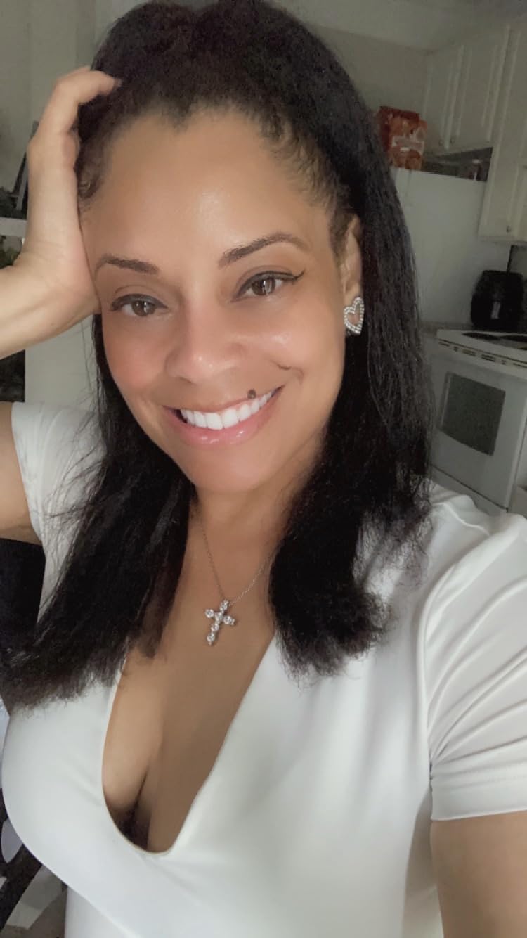 Trophy Skin MicrodermMD - At Home Microdermabrasion Kit - Anti Aging and Acne Treatment - Contains Real Diamond and Pore Extractor Tips to Rejuvenate Skin - White customer photo 2