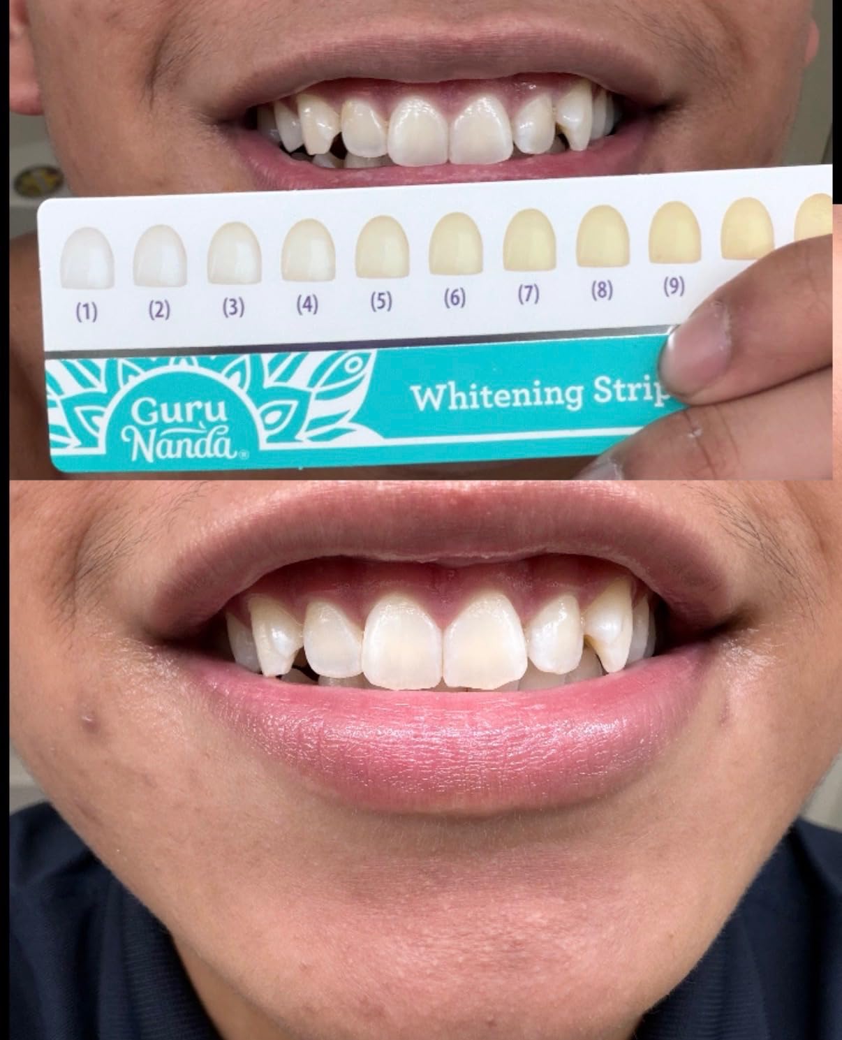 GuruNanda Teeth Whitening Strips - 4X Whiter Teeth, 7-Day Whitening Kit customer photo 1