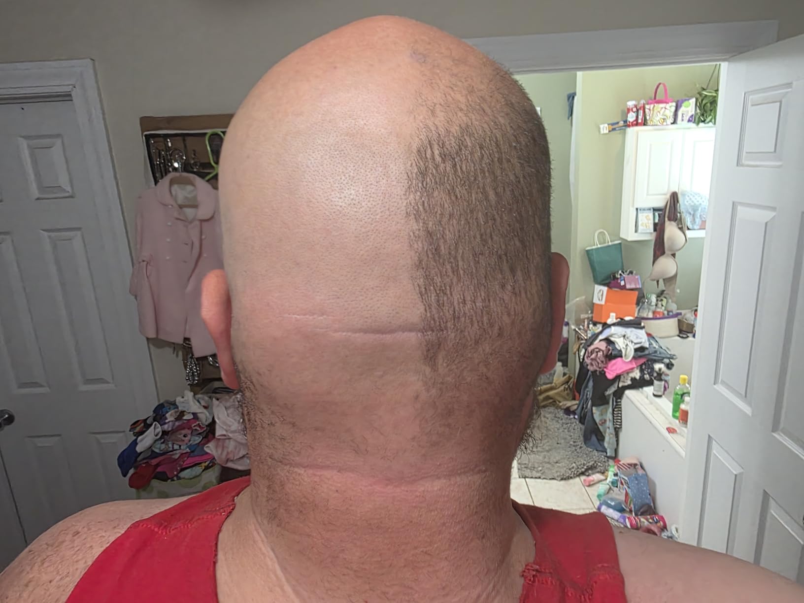 MANSCAPED® The Dome Shaver™ PRO Head Shaver for Bald Men customer photo 1