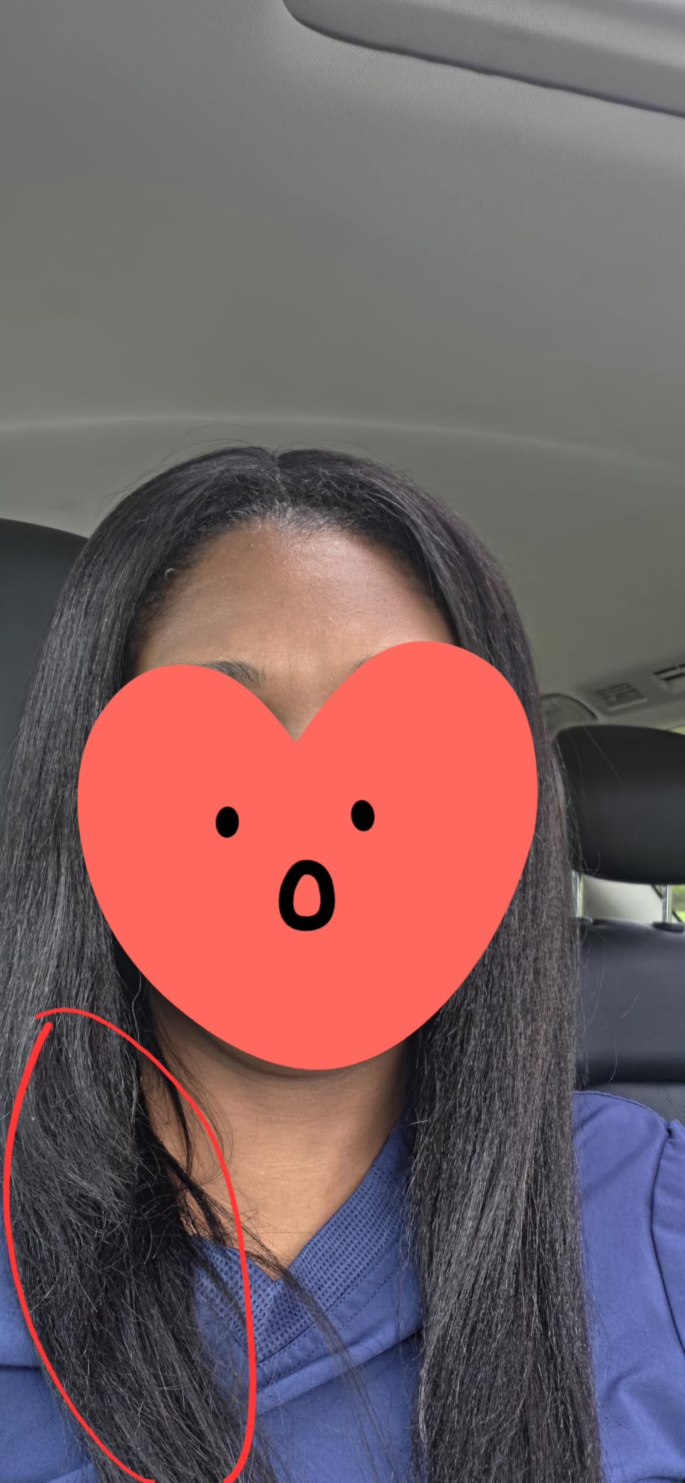UNICE Bye Bye Knots Wig Yaki Straight 7x5 Pre Cut HD Lace Front Wigs Human Hair with Elastic Drawstring Glueless Wig Human Hair Pre Plucked Bleached Knots Natural Hairline 150% Density 18 inches customer photo 1