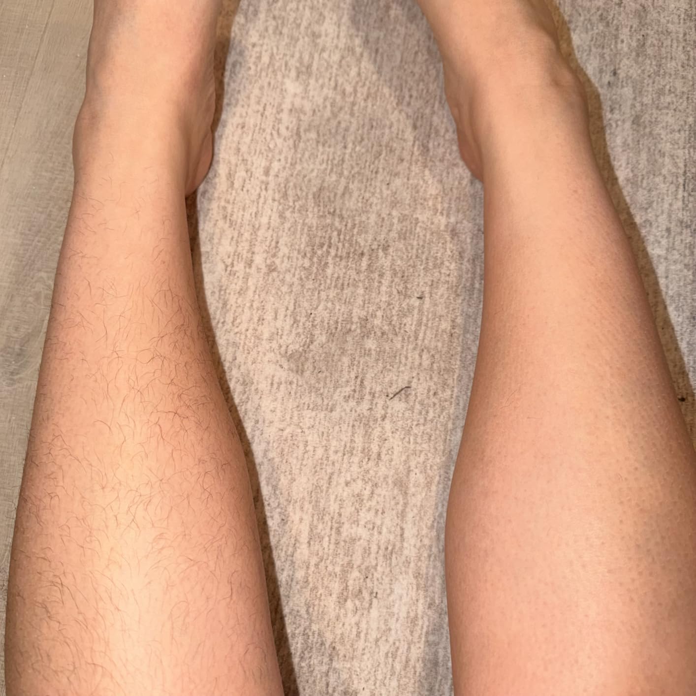 Philips Epilator Series 2000, Corded Epilator for Legs and Body, Hair Removal Device for Women, Model BRE227/00 customer photo 2