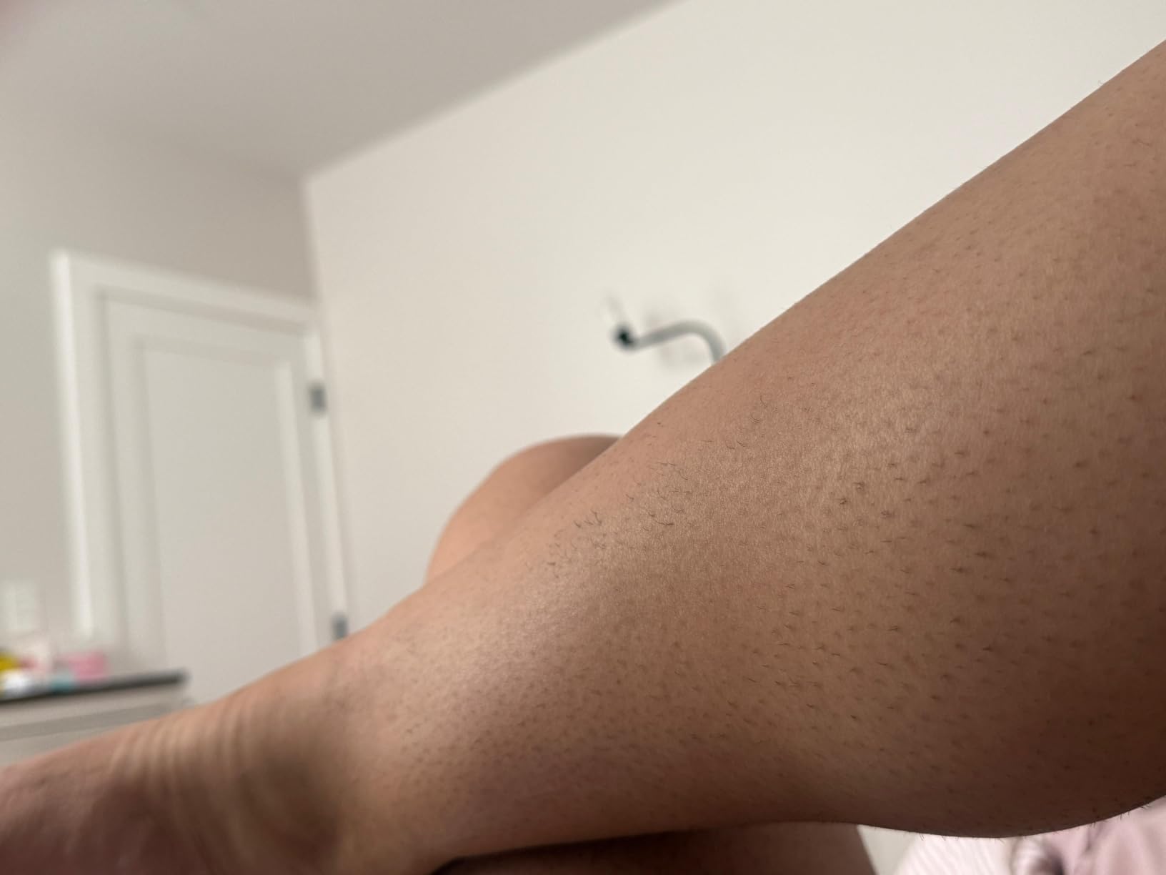 Philips Lumea IPL - Salon-Like Laser Hair Removal for Women, Permanent Hair Reduction Device At Home for Face & Body - Safe & Painless for Face, Bikini, Body, 5 Settings & Skin Sensors, BRI984/03 customer photo 2