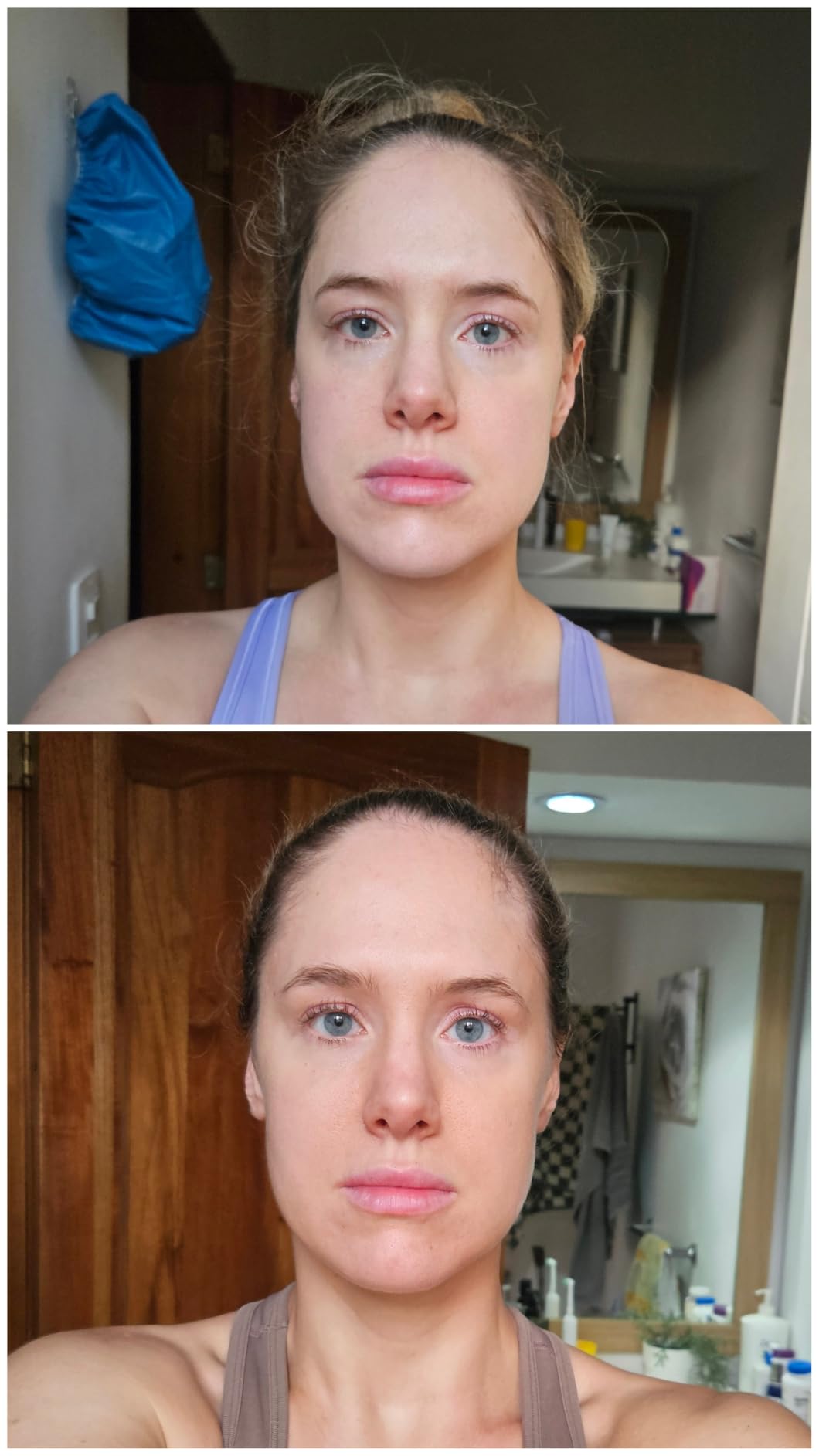 INIA FLARE 3-in-1 Red Light Therapy Beauty Device for Face & Neck Pink customer photo 2