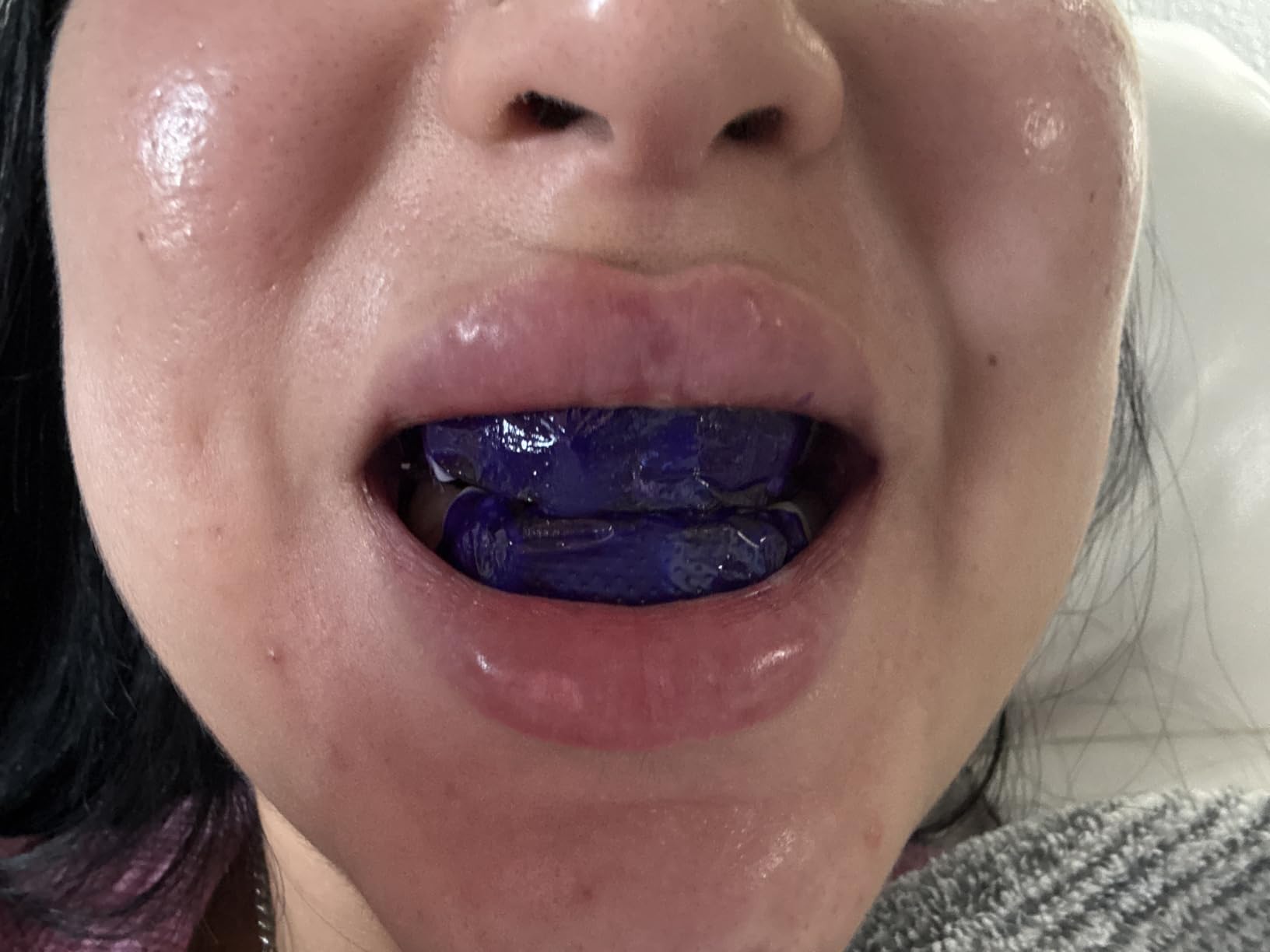 Purple Teeth Whitening Strips - 28 Teeth Whitener Strips (14 Uses) | Purple Color-Correcting Gel Technology | Teeth Whitening Kit for Sensitive Teeth | Enamel Safe, Peroxide-Free for a Brighter Smile customer photo 2